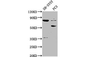 ABLIM1 Antikörper  (AA 174-319)