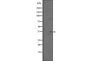 Western blot analysis of OR5AN1 expression in Human placenta tissue lysates ,The lane on the left is treated with the antigen-specific peptide.