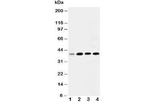 Western blot testing of IGFBP3 antibody and Lane 1:  293T;  2: MCF- 7;  3: A549;  4: SW620.