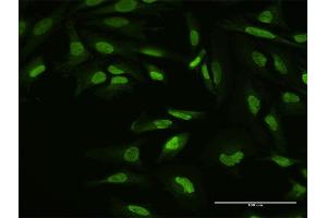 Immunofluorescence of purified MaxPab antibody to YY1 on HeLa cell. (YY1 anticorps  (AA 1-414))