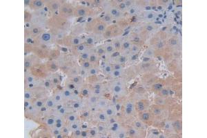 Used in DAB staining on fromalin fixed paraffin- embedded Kidney tissue (SERPINC1 anticorps  (AA 1-259))