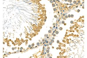 ABIN6266021 and ABIN6277022 at 1/100 staining Rat testis tissue by IHC-P. (WDR5 anticorps  (N-Term))