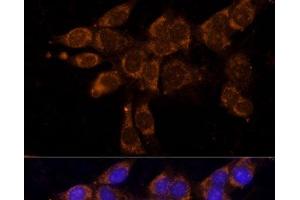 Immunofluorescence analysis of NIH/3T3 cells using CYP11A1 Polyclonal Antibody at dilution of 1:100. (CYP11A1 anticorps)