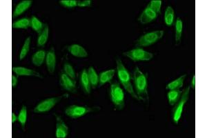 Immunofluorescent analysis of Hela cells using ABIN7153022 at dilution of 1:100 and Alexa Fluor 488-congugated AffiniPure Goat Anti-Rabbit IgG(H+L)