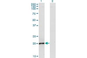 Western Blot analysis of IL6 expression in transfected 293T cell line by IL6 monoclonal antibody (M02), clone 2D12. (IL-6 anticorps  (AA 29-212))