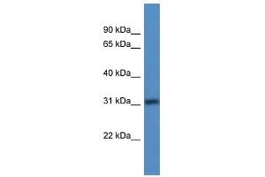 Western Blot showing TBRG1 antibody used at a concentration of 1-2 ug/ml to detect its target protein. (TBRG1 anticorps  (N-Term))