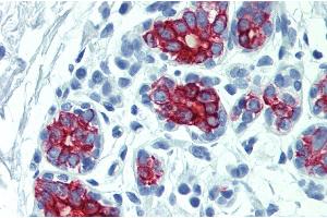 Immunohistochemistry staining of human breast (paraffin-embedded sections) with anti-cytokeratin 7+17. (Keratin 7/17 anticorps)