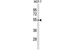 Western blot analysis of ADAMDEC1 Antibody (N-term) in MCF-7 cell line lysates (35 µg/lane).