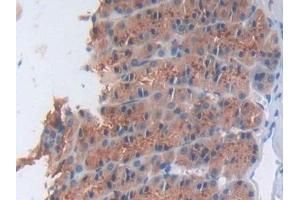 Detection of NOX1 in Rat Stomach Tissue using Polyclonal Antibody to Nicotinamide Adenine Dinucleotide Phosphate Oxidase 1 (NOX1) (NOX1 anticorps  (AA 291-544))