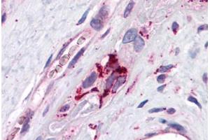 Human Placenta: Formalin-Fixed, Paraffin-Embedded (FFPE) (ADRP anticorps  (AA 28-281))