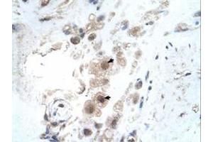 Immunohistochemical staining (Formalin-fixed paraffin-embedded sections) of human placenta with KIAA0494 polyclonal antibody  at 4-8 ug/mL working concentration. (KIAA0494 anticorps  (N-Term))