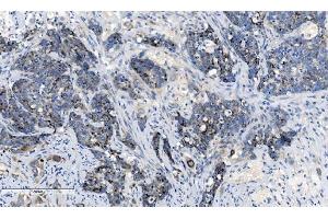 IHC analysis of CHCHD10 using anti-CHCHD10 antibody (ABIN7602507). (CHCHD10 anticorps  (AA 80-142))