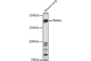 Western blot analysis of extracts of Mouse lung, using TRPM2 antibody (ABIN6128836, ABIN6149582, ABIN6149583 and ABIN6221738) at 1:500 dilution.