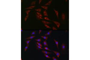 Immunofluorescence analysis of NIH/3T3 cells using eIF4 Rabbit pAb (ABIN6129659, ABIN6140076, ABIN6140077 and ABIN6220909) at dilution of 1:100 (40x lens). (EIF4A1 anticorps  (AA 1-406))
