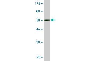 Western Blot detection against Immunogen (61. (RPRD1B anticorps  (AA 1-326))