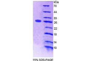 SDS-PAGE analysis of Mouse SNAP23 Protein. (SNAP23 Protéine)