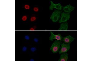 ABIN7094789 and ABIN7098840 staining HepG2 cells by IF/ICC. (IRF8 anticorps  (Internal Region))
