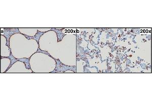 SP-A immunohistochemistry. (Surfactant Protein A1 anticorps  (Internal Region))