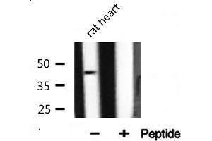 Western blot analysis of extracts from rat liver, using ILKAP antibody. (ILKAP anticorps  (N-Term))
