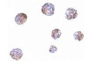 Immunocytochemistry of GNPDA1 in 293 cells with AP30368PU-N GNPDA1 antibody at 5 μg/ml.