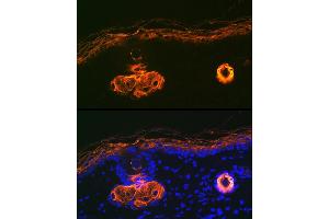 Immunofluorescence analysis of rat skin using Cytokeratin 2e (KRT2) Rabbit mAb (ABIN1680763, ABIN3016322, ABIN3016323 and ABIN7101480) at dilution of 1:100 (40x lens).
