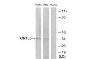Western Blotting (WB) image for anti-Olfactory Receptor, Family 1, Subfamily L, Member 6 (OR1L6) (AA 111-160) antibody (ABIN2890972) (OR1L6 anticorps  (AA 111-160))