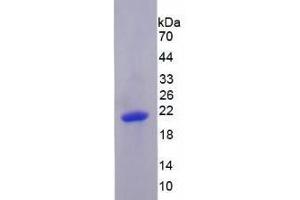 SDS-PAGE analysis of Human PRDM1 Protein. (PRDM1 Protéine)