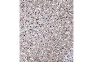 Immunohistochemical analysis of A on paraffin-embedded Human liver tissue.