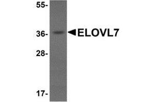 Western blot analysis of ELOVL7 in human liver tissue lysate with AP30312PU-N ELOVL7 antibody at 1 μg/ml. (ELOVL7 anticorps  (N-Term))