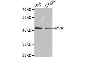 Western blot analysis of extracts of various cell lines, using MVK antibody. (MVK anticorps)