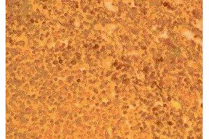 Immunohistochemistry (IHC) image for anti-Chemokine (C-C Motif) Receptor 2 (CCR2) (N-Term) antibody (ABIN2478964)
