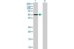 Western Blot analysis of PPP1R12B expression in transfected 293T cell line by PPP1R12B MaxPab polyclonal antibody. (PPP1R12B anticorps  (AA 1-386))