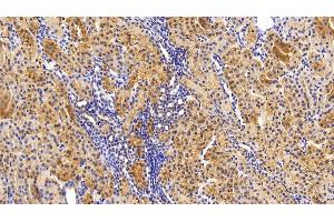 Detection of TXNIP in Human Kidney Tissue using Polyclonal Antibody to Thioredoxin-interacting Protein (TXNIP)