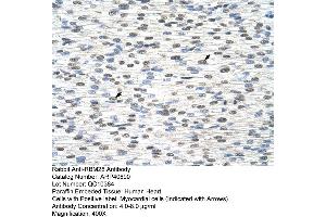 Rabbit Anti-RBM28 Antibody  Paraffin Embedded Tissue: Human Heart Cellular Data: Myocardial cells Antibody Concentration: 4. (RBM28 anticorps  (C-Term))