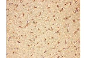 IHC-P: CNTF antibody testing of mouse brain tissue (CNTF anticorps  (AA 2-198))