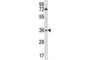 XRCC2 antibody western blot analysis in ZR-75-1 lysate