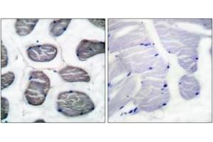 Immunohistochemistry analysis of paraffin-embedded human muscle tissue, using Actin-alpha-1 Antibody. (Actin anticorps  (AA 1-50))