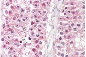 Anti-CSNK2A1 / CKII antibody IHC staining of human testis.