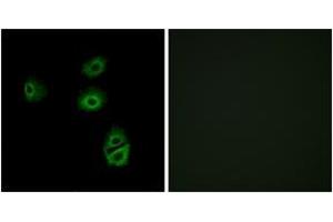 Immunofluorescence analysis of A549 cells, using OR2B2 Antibody. (OR2B2 anticorps  (AA 241-290))