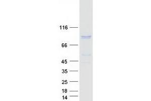 Validation with Western Blot