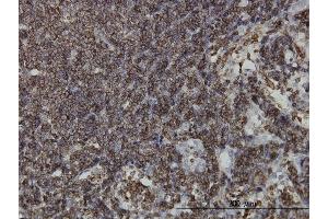 Immunoperoxidase of monoclonal antibody to HCLS1 on formalin-fixed paraffin-embedded human lymph node. (HCLS1 anticorps  (AA 266-355))
