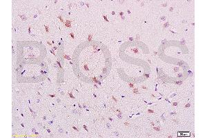 Formalin-fixed and paraffin embedded rat brain labeled with Anti-phospho-NRP1(Thr916) Polyclonal Antibody, Unconjugated (ABIN710756) at 1:200 followed by conjugation to the secondary antibody and DAB staining. (Neuropilin 1 anticorps  (pThr916))