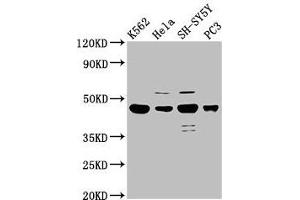Western Blot Positive WB detected in: K562 whole cell lysate, Hela whole cell lysate, SH-SY5Y whole cell lysate, PC-3 whole cell lysate All lanes: LYAR antibody at 2. (LYAR anticorps  (AA 1-379))