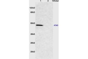 Lane 1: mouse brain lysates Lane 2: mouse kidney lysates probed with Anti Smad3 Polyclonal Antibody, Unconjugated (ABIN747023) at 1:200 in 4 °C. (Smad2/3 anticorps  (AA 30-80))