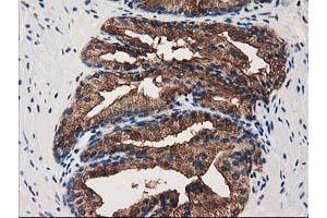 Image no. 2 for anti-Annexin A3 (ANXA3) antibody (ABIN1496642)