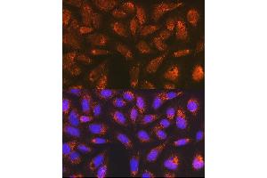 Immunofluorescence analysis of U-2 OS cells using Versican Rabbit mAb (ABIN7271309) at dilution of 1:100 (40x lens). (Versican anticorps)