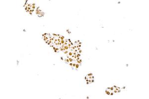 Immunocytochemistry (ICC) image for anti-Paired Box 8 (PAX8) (AA 225-275) antibody (ABIN7795777) (Recombinant PAX8 anticorps  (AA 225-275))