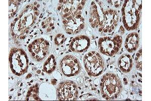 Image no. 2 for anti-Mitogen-Activated Protein Kinase 4 (MAPK4) antibody (ABIN1499312)