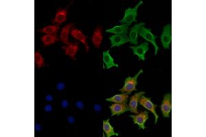 ABIN6258647 and ABIN6273571 staining HepG2 cells by IF/ICC.