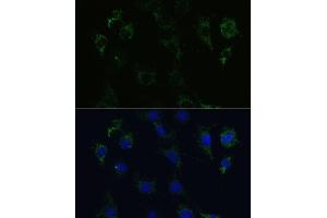 Immunofluorescence analysis of C6 cells using STX1A Polyclonal Antibody (ABIN6132695, ABIN6148659, ABIN6148661 and ABIN6221218) at dilution of 1:100 (40x lens). (STX1A anticorps  (AA 1-288))